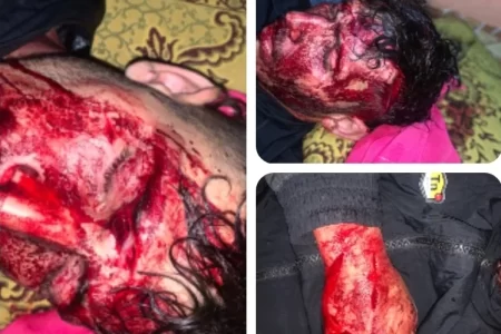 تصاعد الانفلات الأمني بدوار الكوحل يثير غضب الساكنة بسيدي علي بنحمدوش